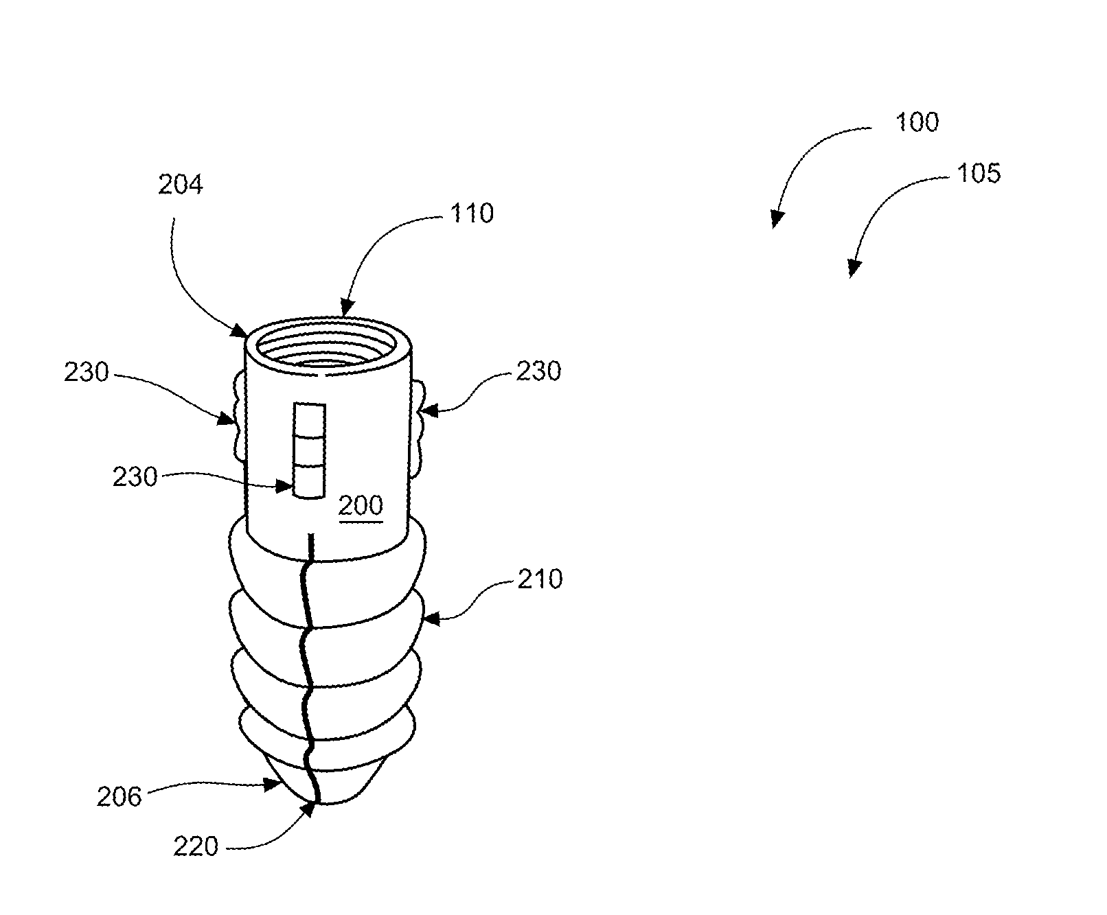 Anchor and toothscrew systems