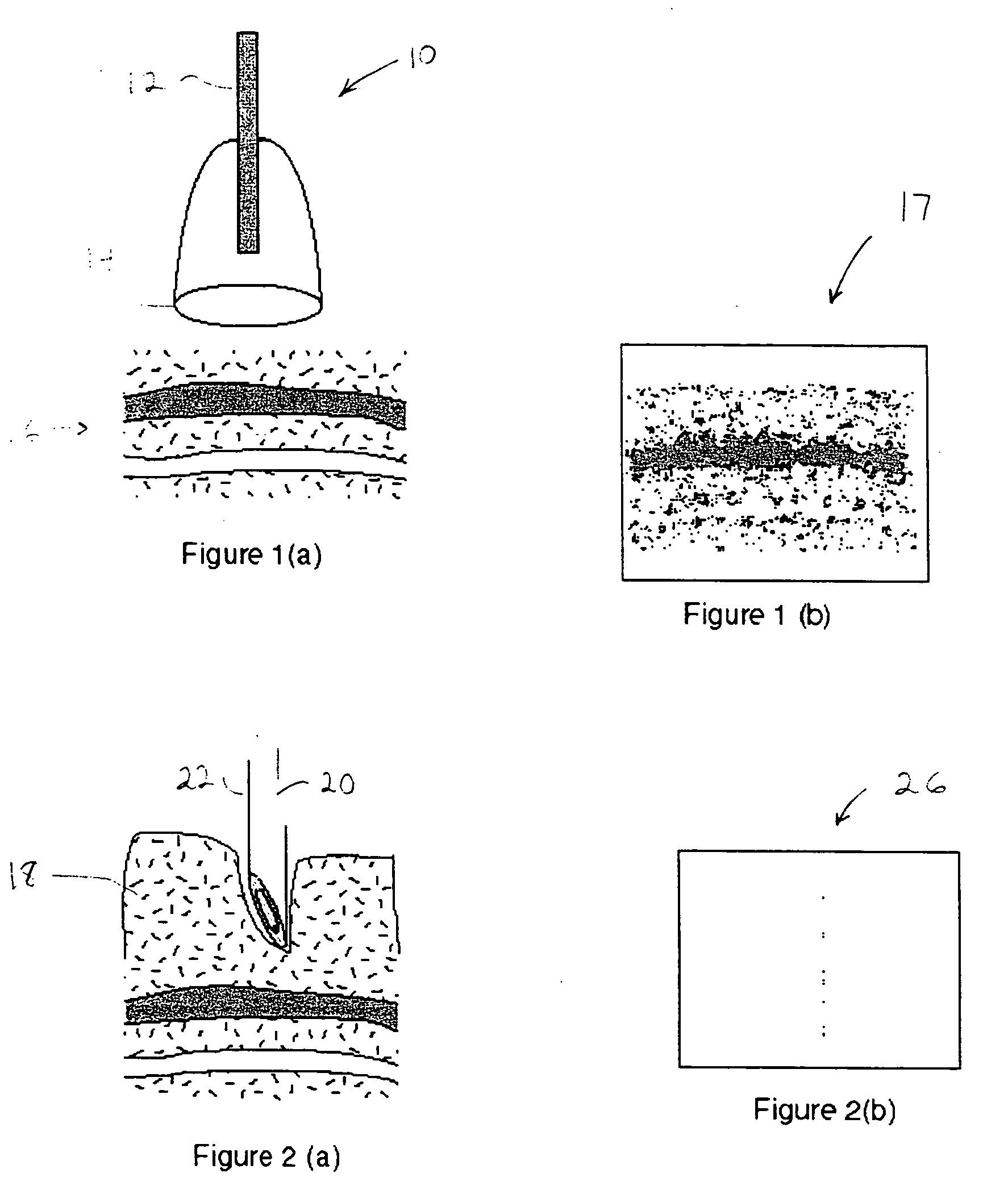 Tissue structure identification in advance of instrument