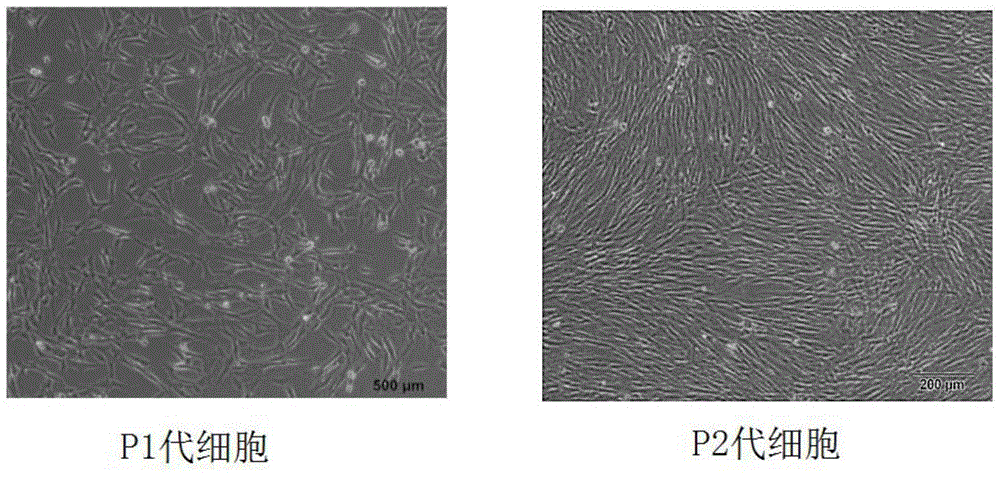 Clinic-level adipose-derived stem cell preparation and storage methods