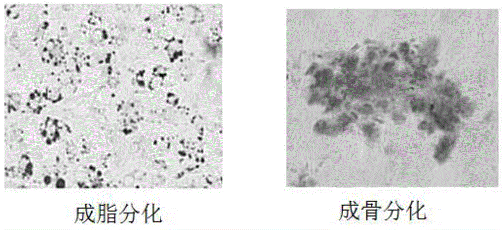 Clinic-level adipose-derived stem cell preparation and storage methods