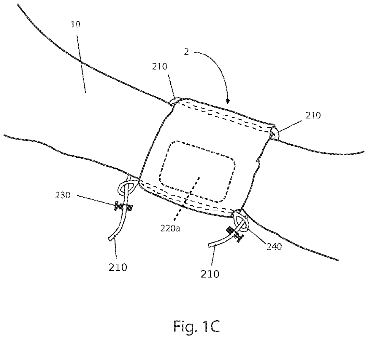 Energy Source Holder System