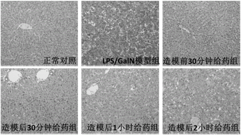 Application of compound HUBIN-1 in preparation of drug for preventing and/or treating liver inflammatory diseases