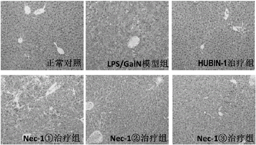 Application of compound HUBIN-1 in preparation of drug for preventing and/or treating liver inflammatory diseases