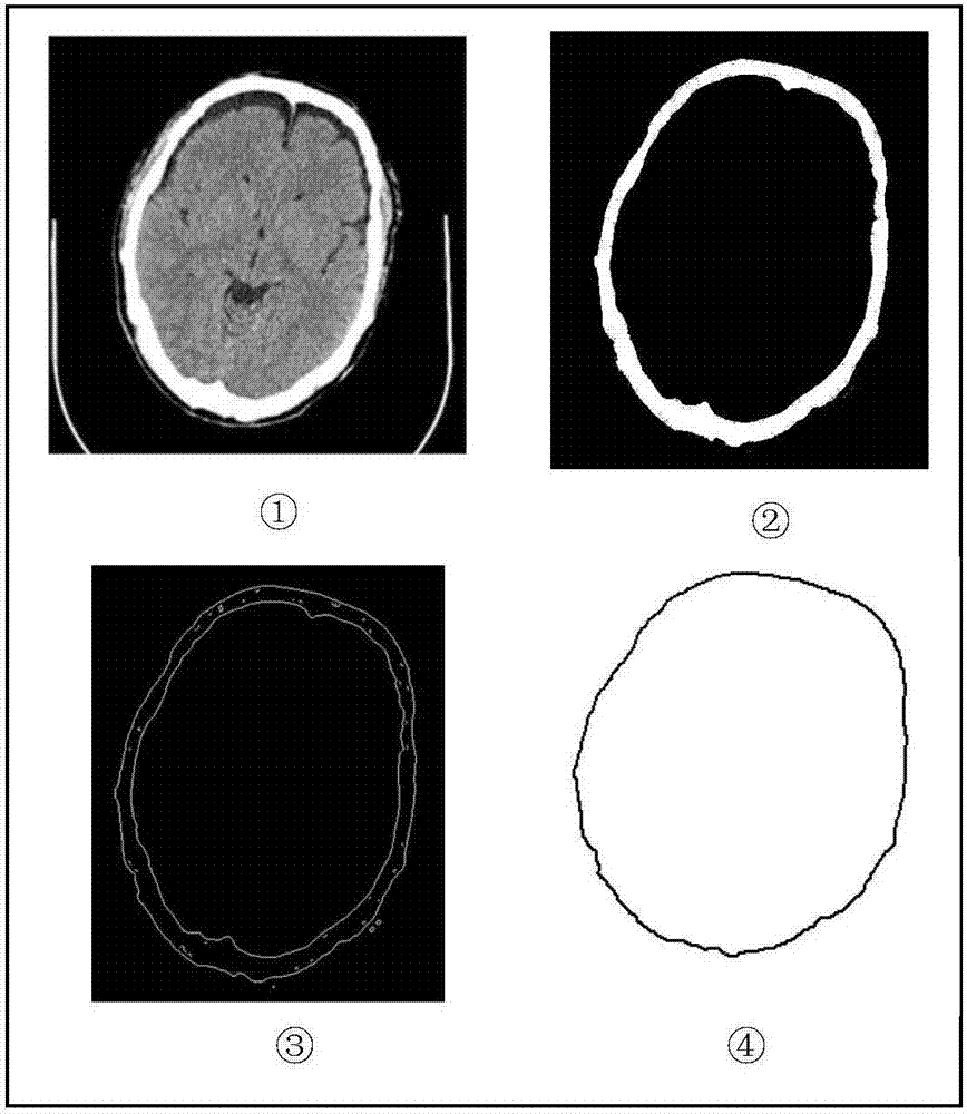 Prior knowledge-based method for reconstructing artificial bone repair model of damaged part