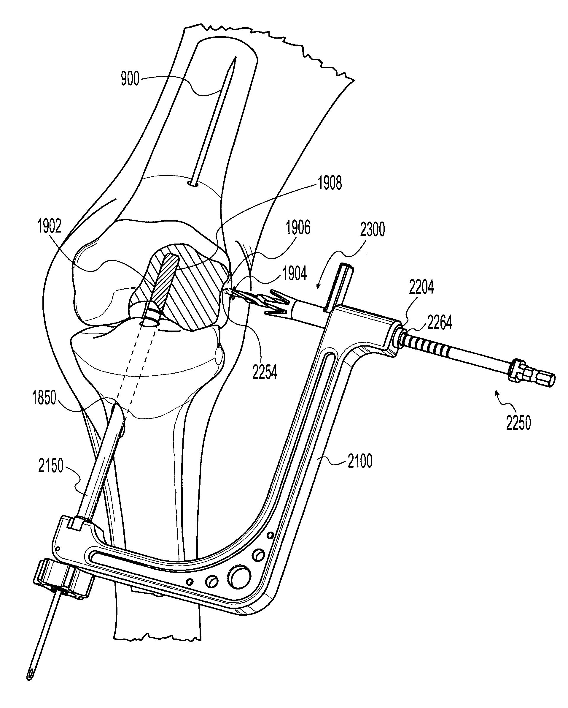 Cross-pin graft fixation, instruments, and methods