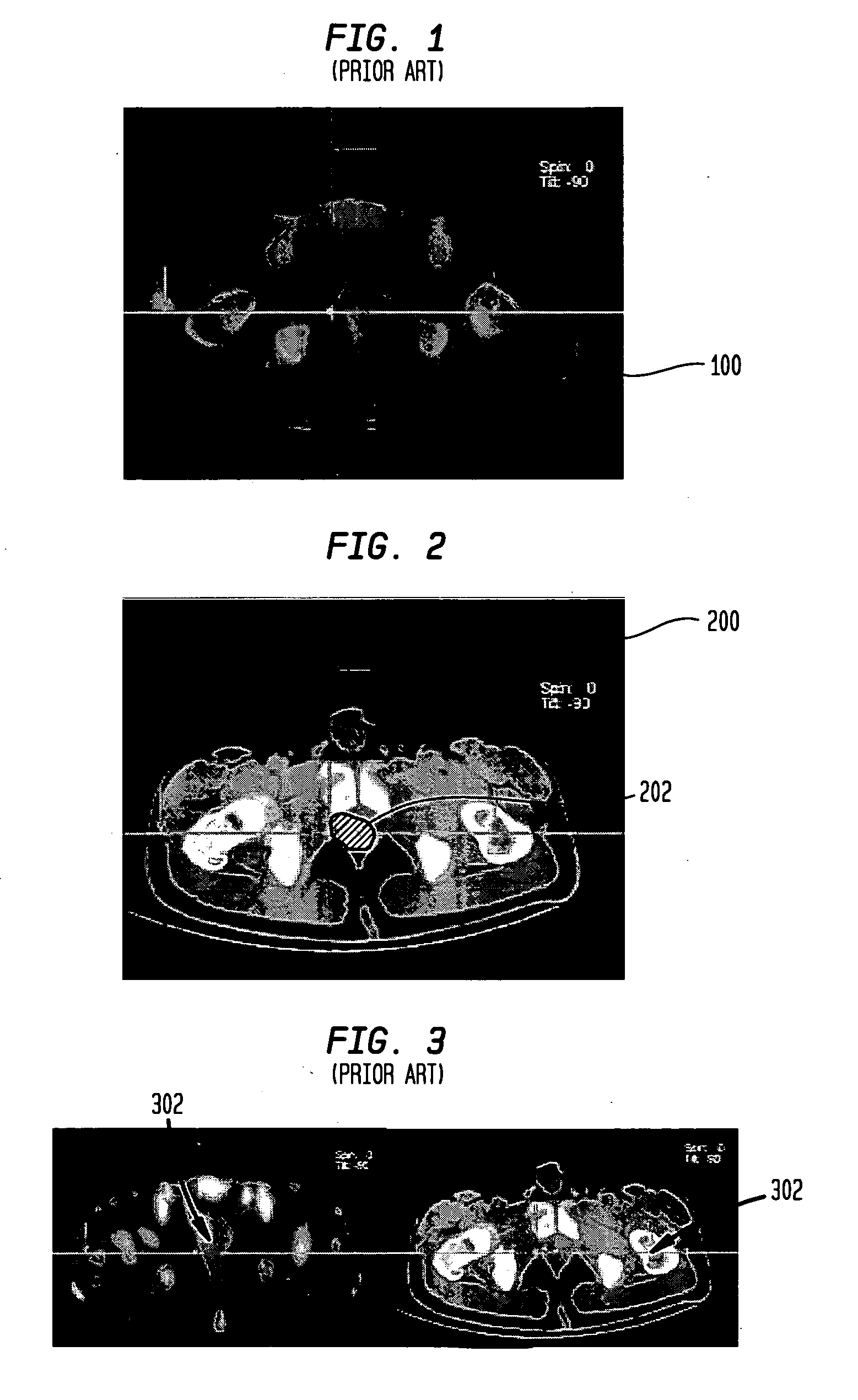 Systems and methods for localized image registration and fusion