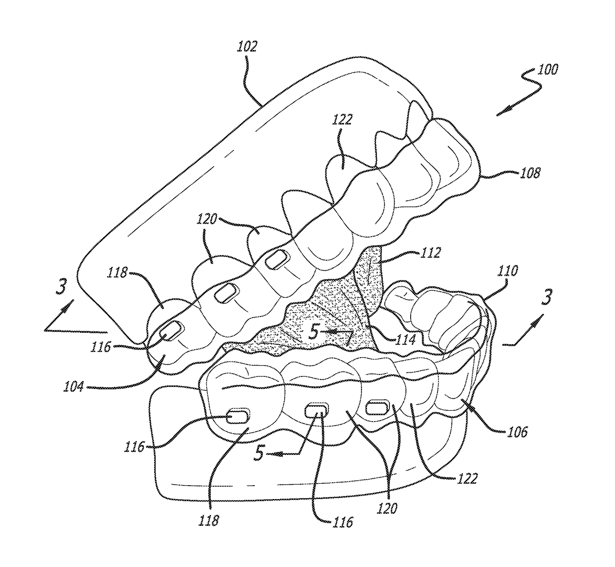 Oral weight control device