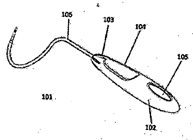 Sling system with removable string