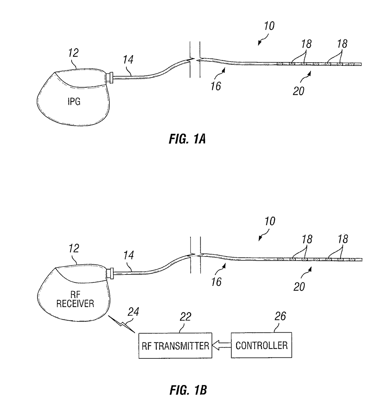 Stimulation design for neuromodulation