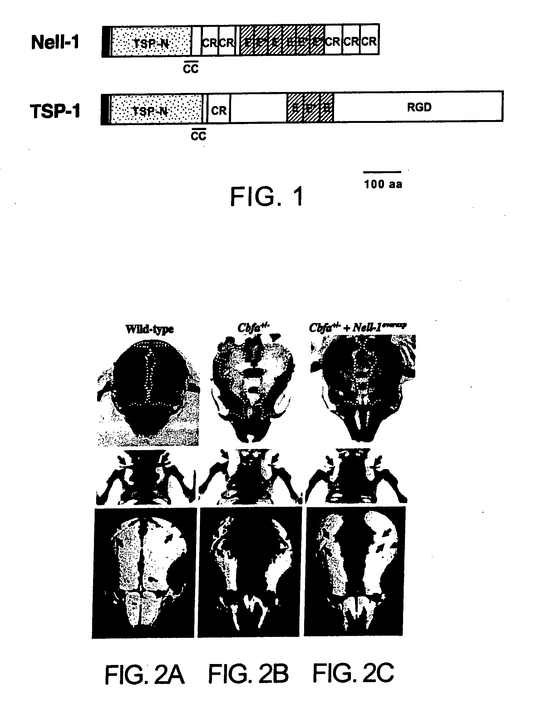 Pharmaceutical Compositions for Treating or Preventing Bone Conditions