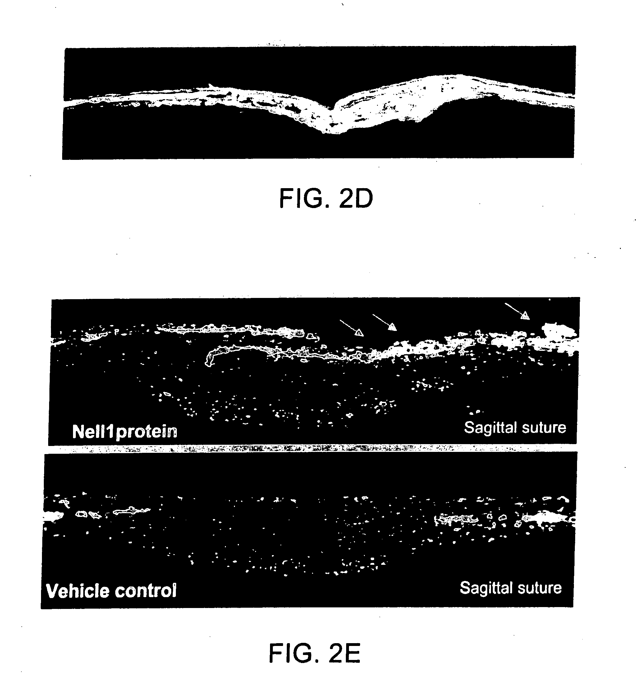 Pharmaceutical Compositions for Treating or Preventing Bone Conditions