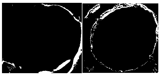 Method for preparing saccharomycete surface atom transfer imprinted adsorbent