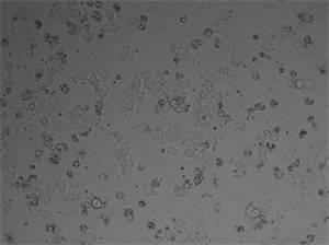 Separation and culture method for primary pig liver cells