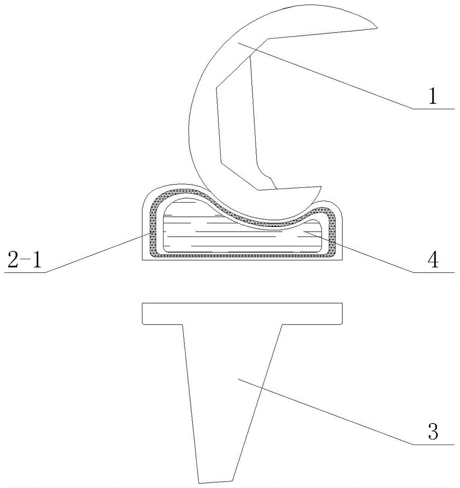 Flexible knee joint prosthesis