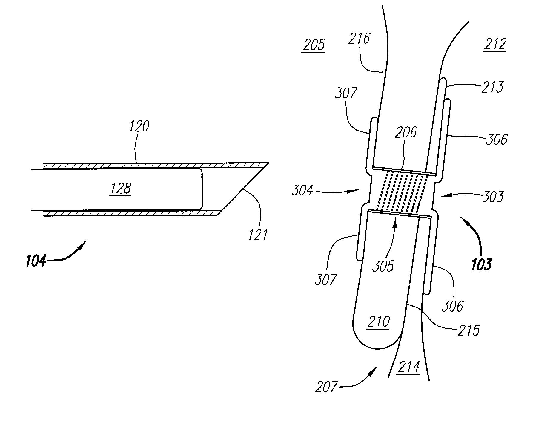 Clip-Based Systems and Methods for Treating Septal Defects