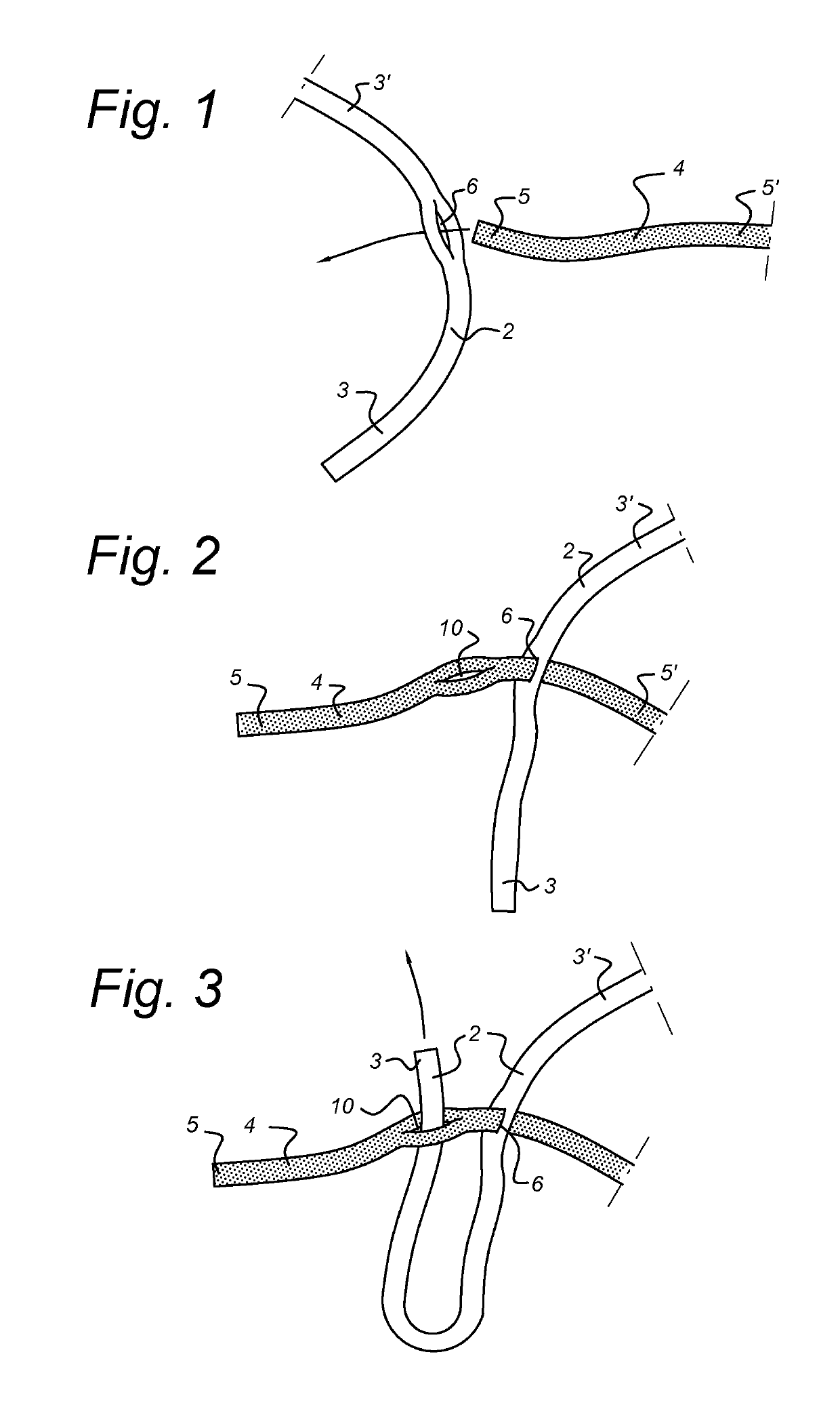 Net and a method of making the same