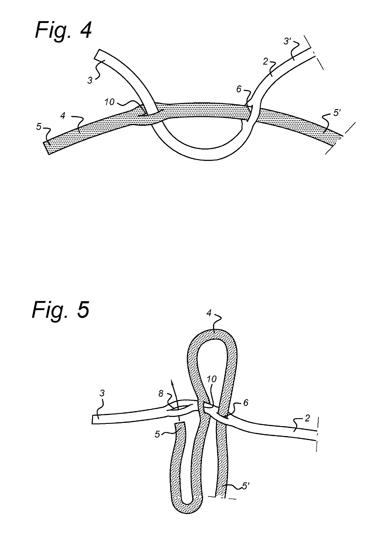 Net and a method of making the same