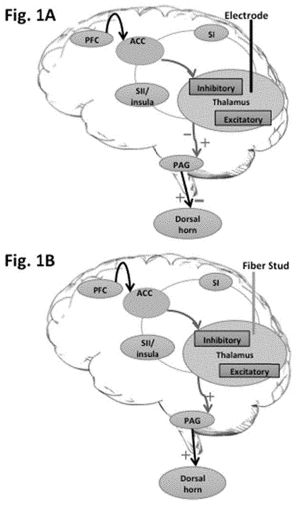 Method and device for pain modulation by optical activation of neurons and other cells