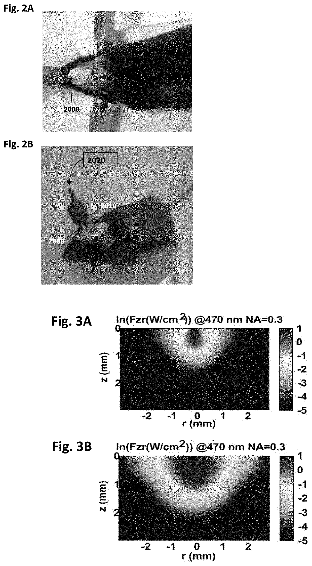 Method and device for pain modulation by optical activation of neurons and other cells