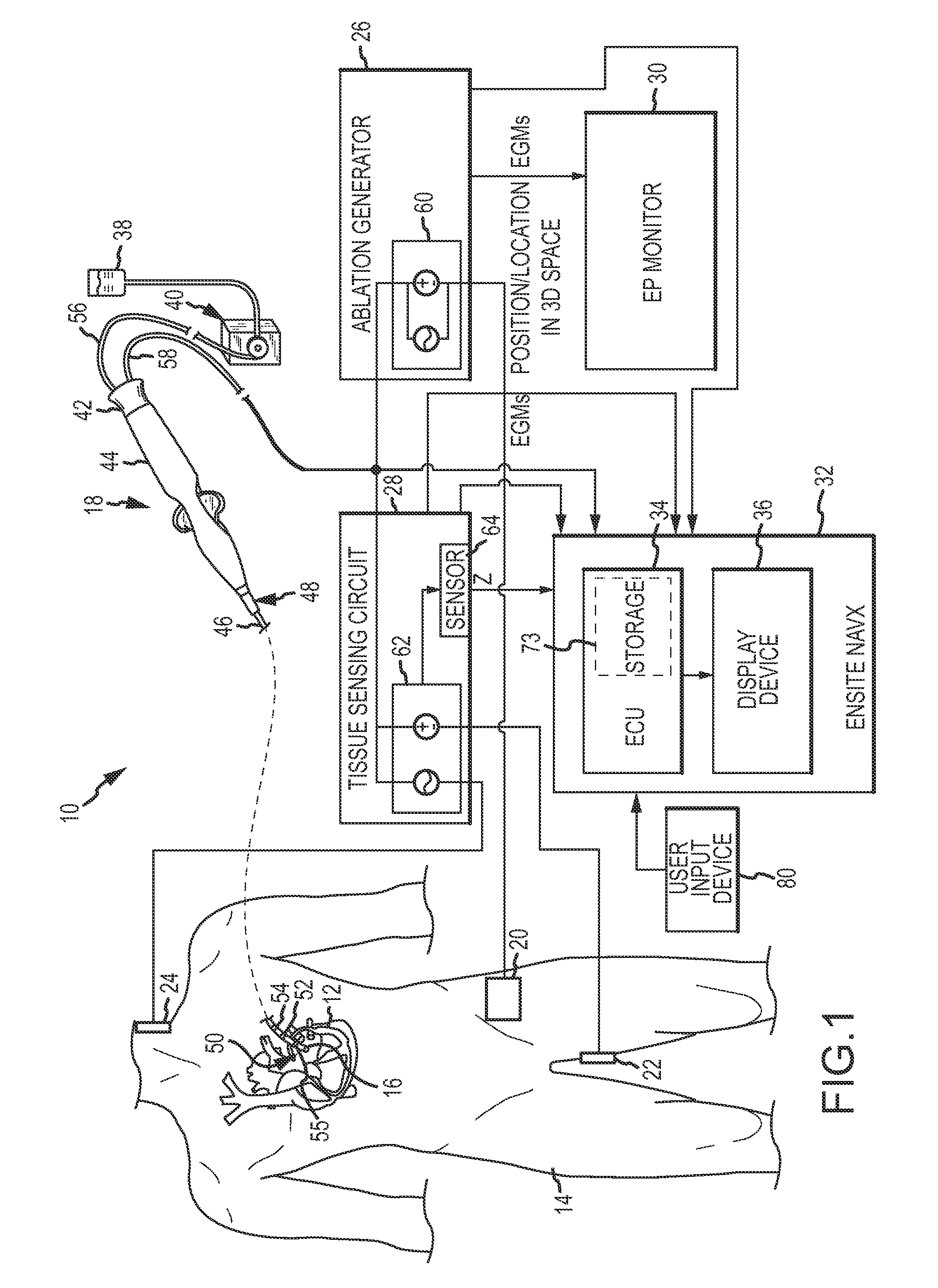 System and method for assessing the formation of a lesion in tissue