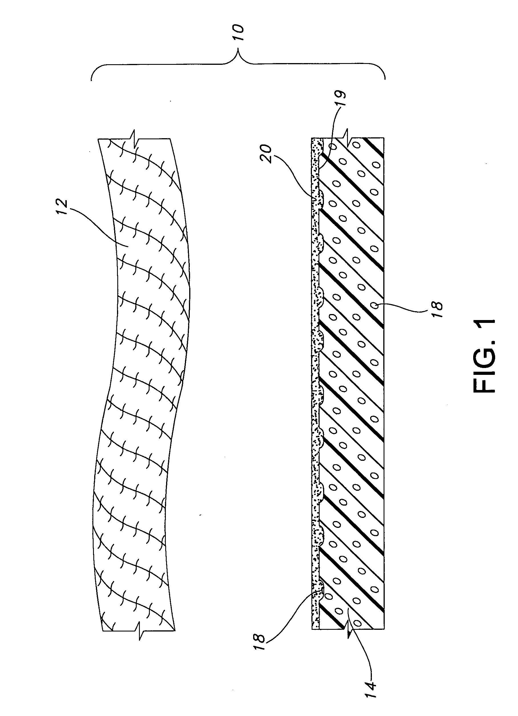 Composite ePTFE/textile prosthesis