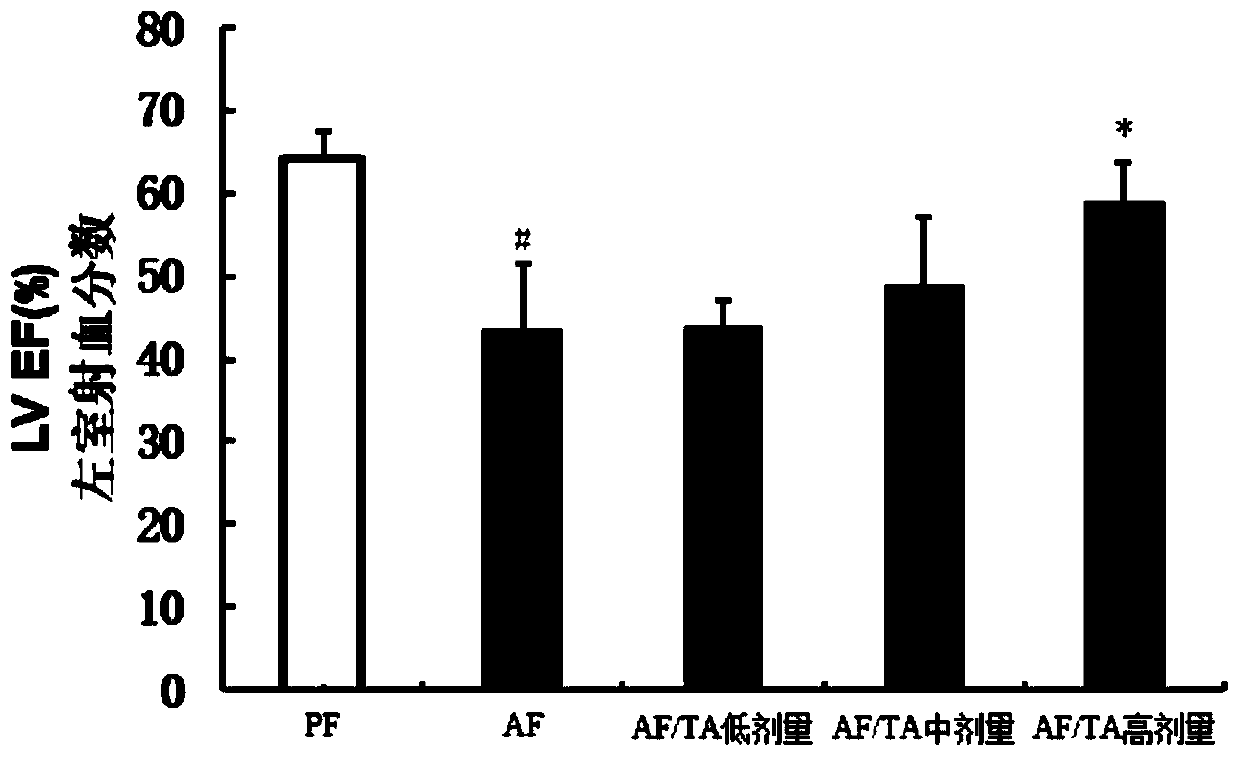 Application of thonningianin A in the preparation of drugs for preventing or treating alcoholic cardiomyopathy