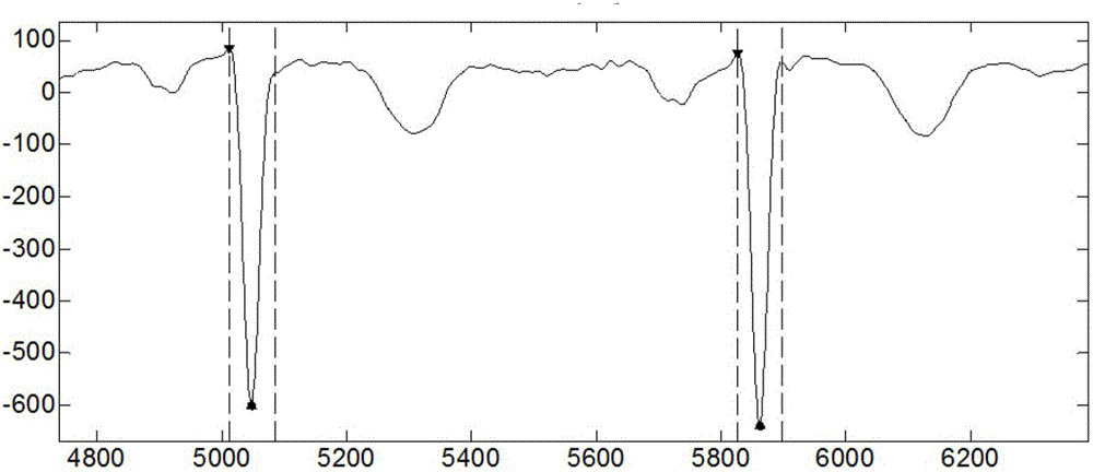 QRS-wave-group detection method