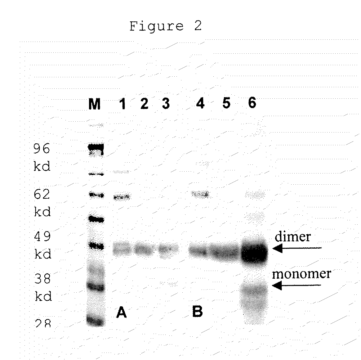 Reference, calibrator, or control composition of PIGF-1 and sFlt-1