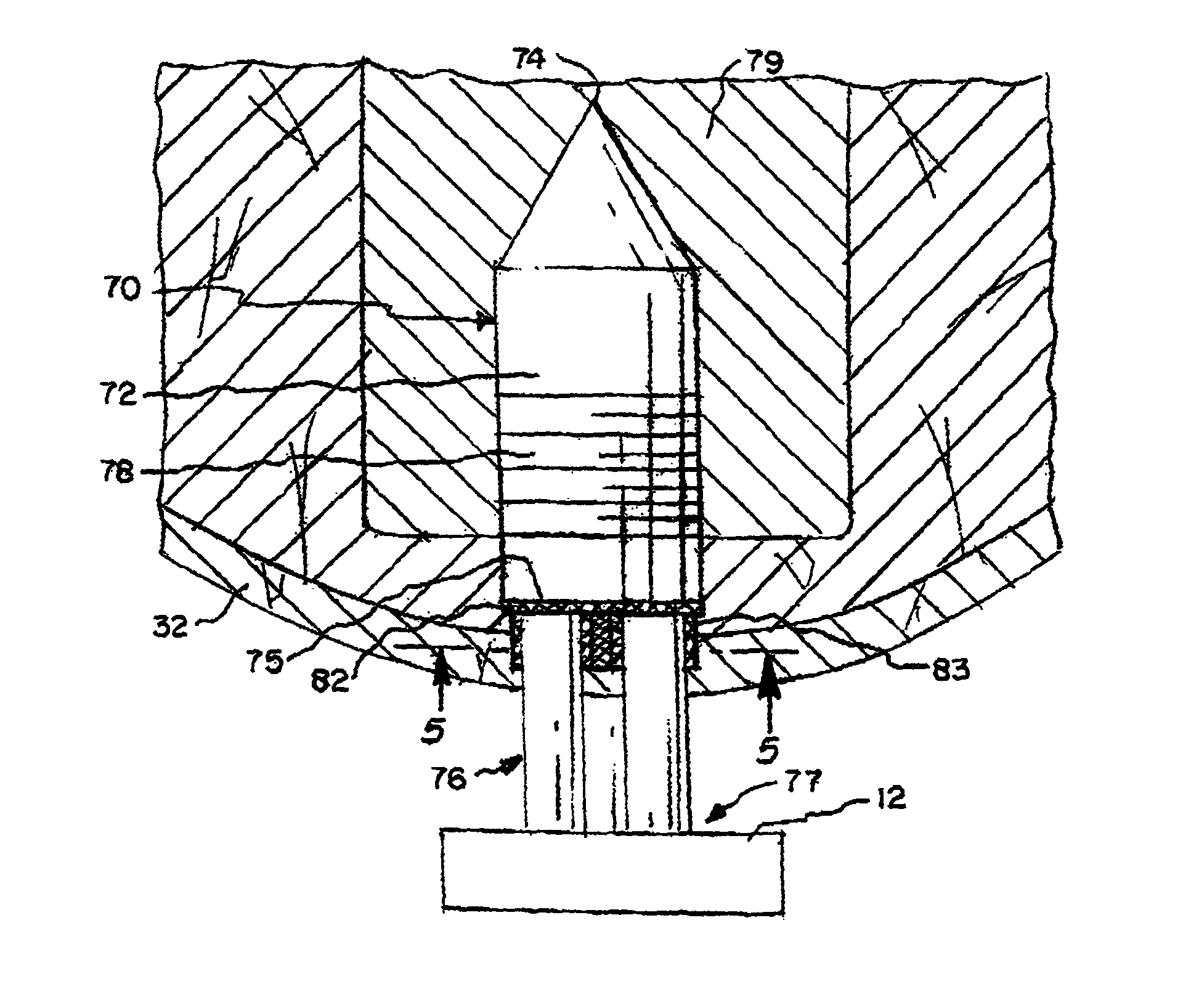 Prosthesis attachment method and apparatus with soft tissue integrating seal