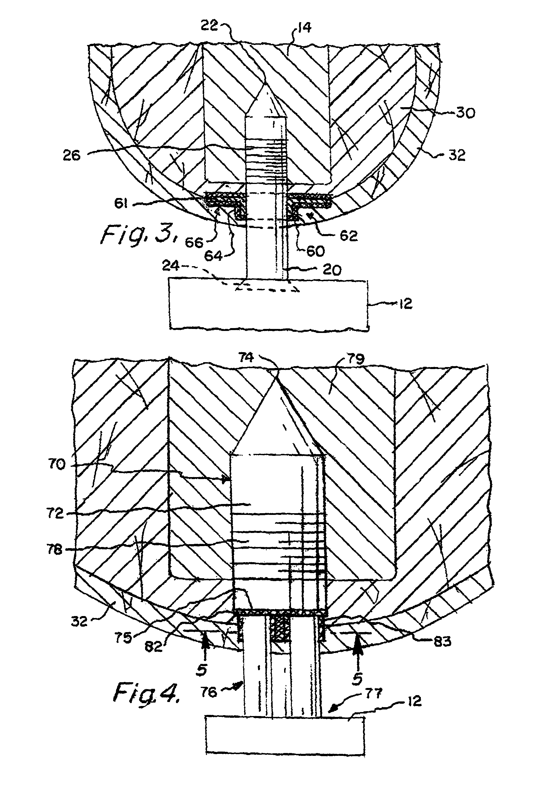 Prosthesis attachment method and apparatus with soft tissue integrating seal