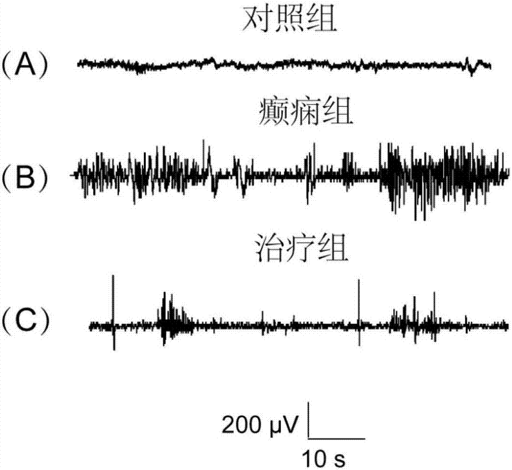 Application of dipeptidyl peptidase IV (DPP4) inhibitors to preparation of drugs used for preventing and treating epilepsy