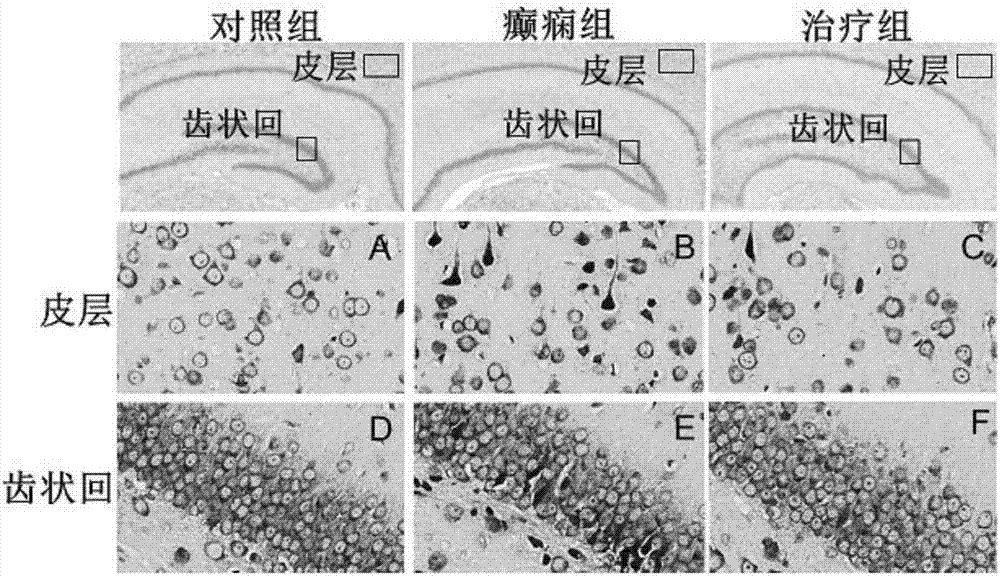 Application of dipeptidyl peptidase IV (DPP4) inhibitors to preparation of drugs used for preventing and treating epilepsy