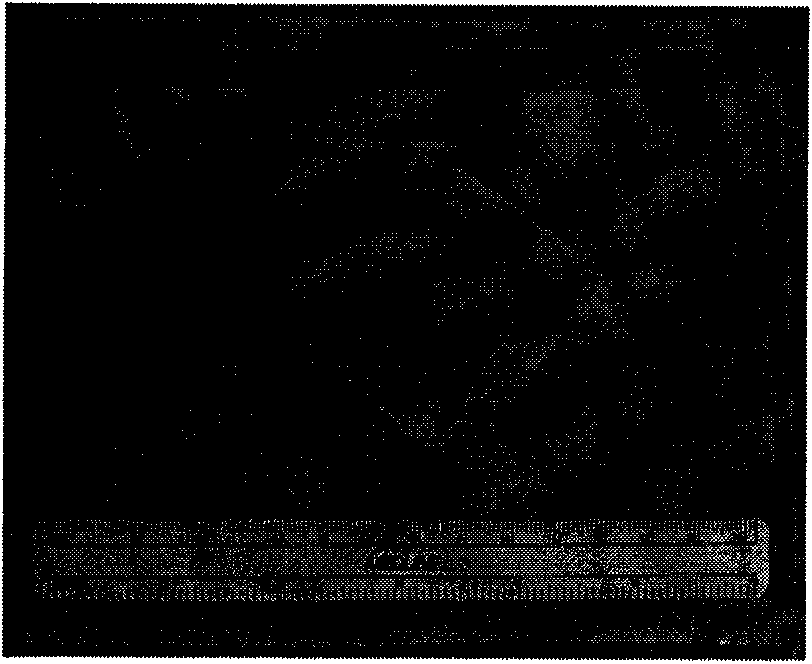 Anti-infection bio-derived hernia and body wall repair material, preparation and application thereof