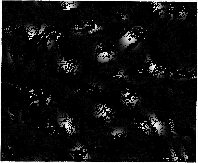 Anti-infection bio-derived hernia and body wall repair material, preparation and application thereof