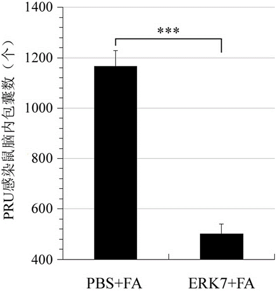 Immune vaccine for preventing toxoplasma gondii infection