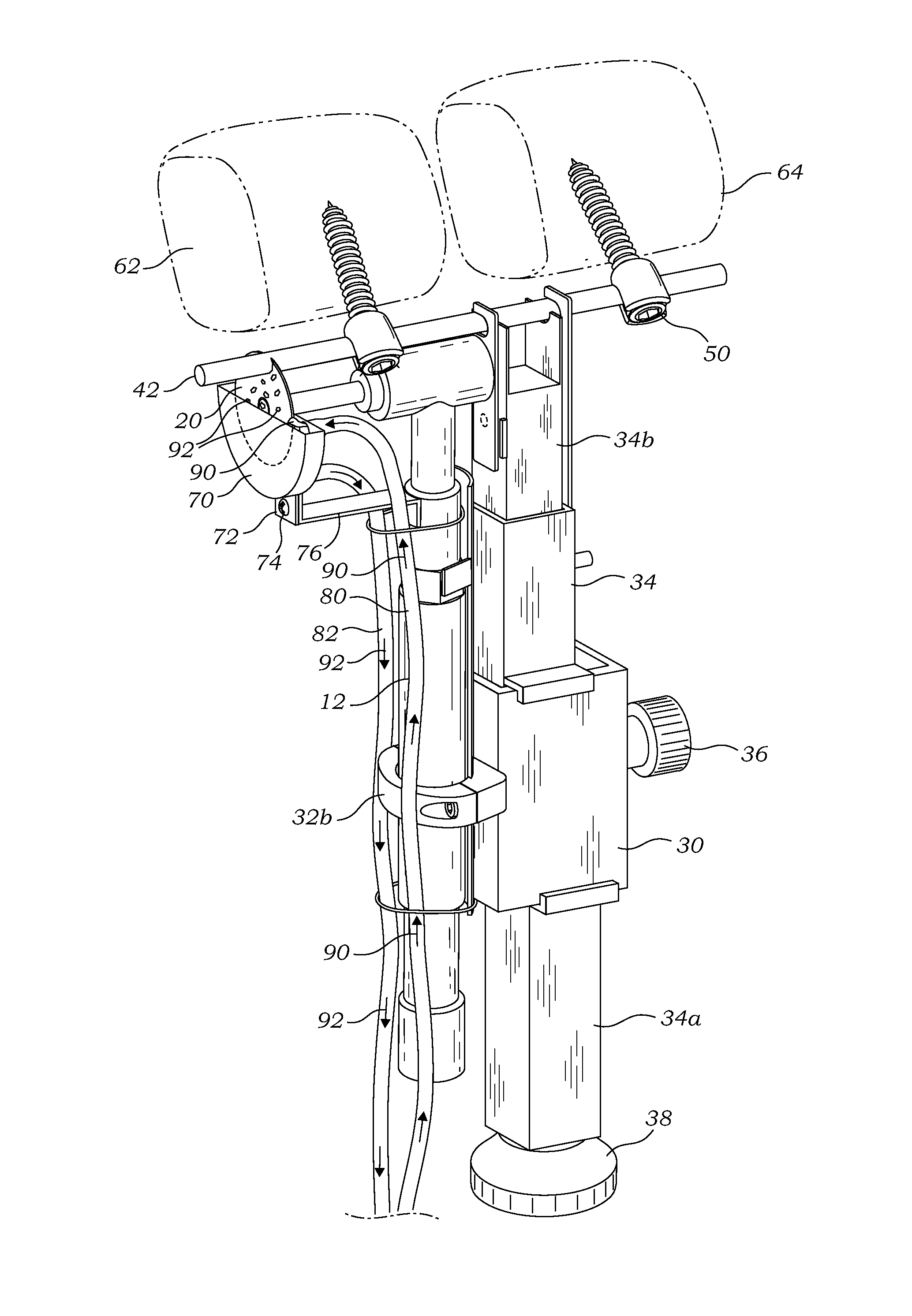 Surgical cutting system and method