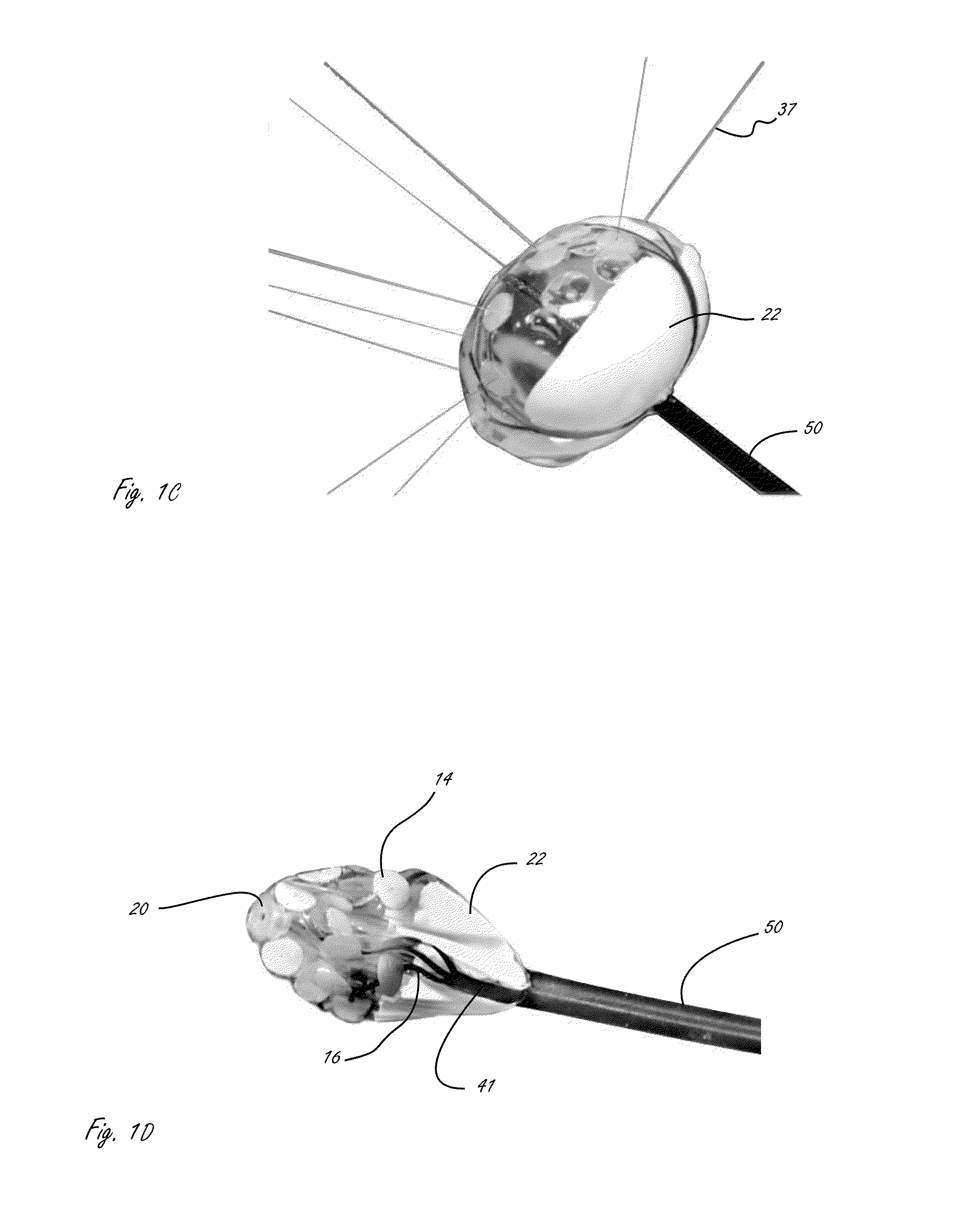 Cardiac ablation catheters and methods of use thereof