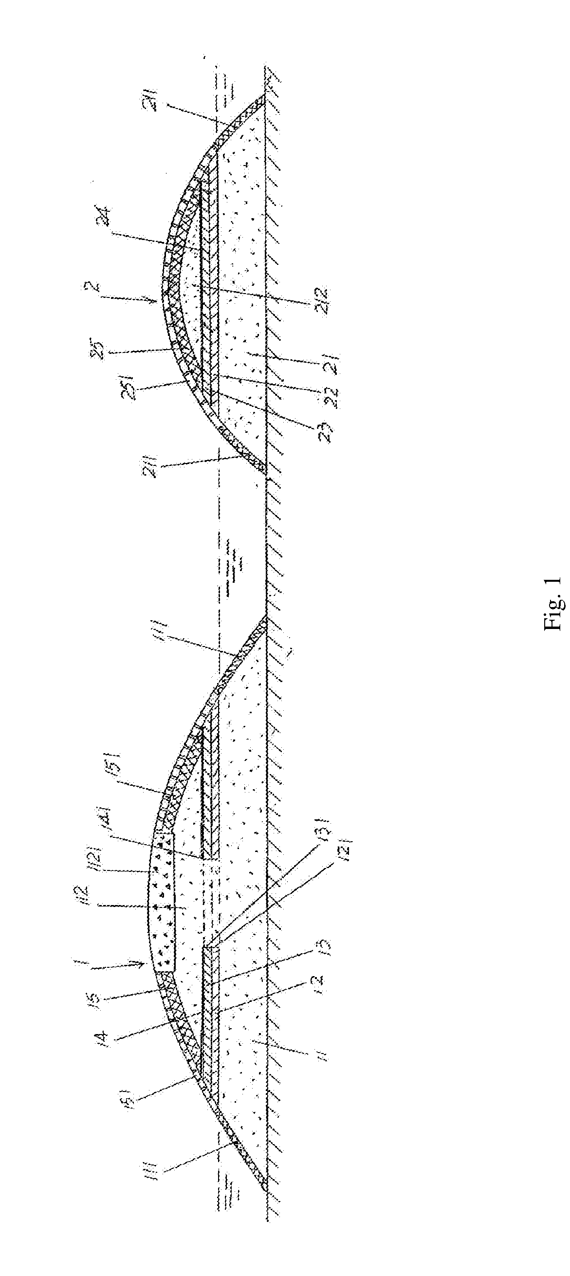 In-situ purification island structure and the construction method thereof