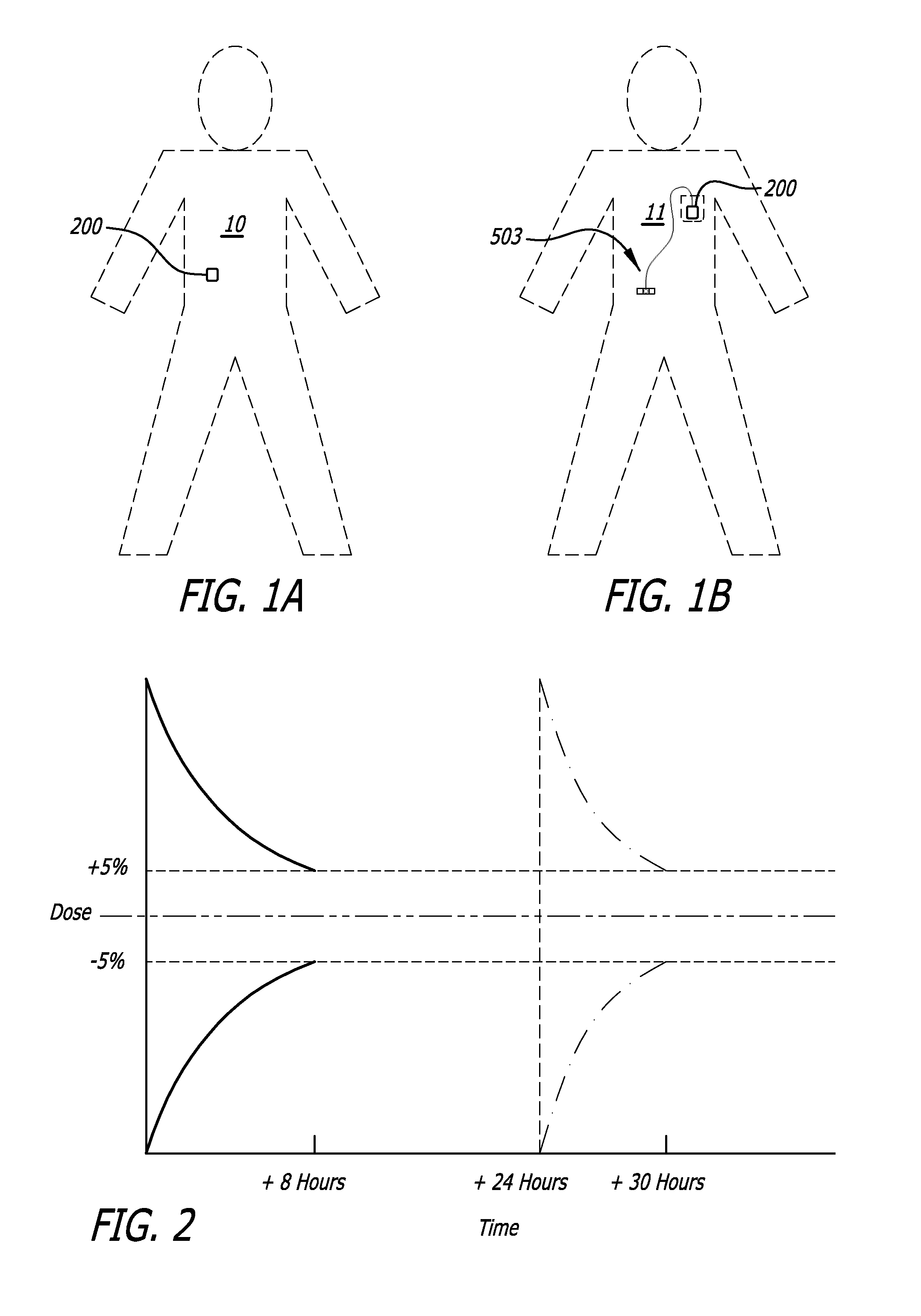 Infusion pumps