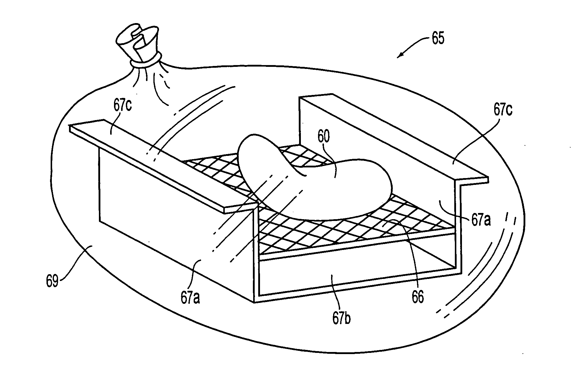 Apparatus and method for maintaining and/or restoring viability of organs