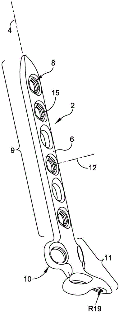 Posterior ankle fusion plate