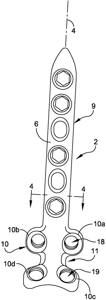 Posterior ankle fusion plate