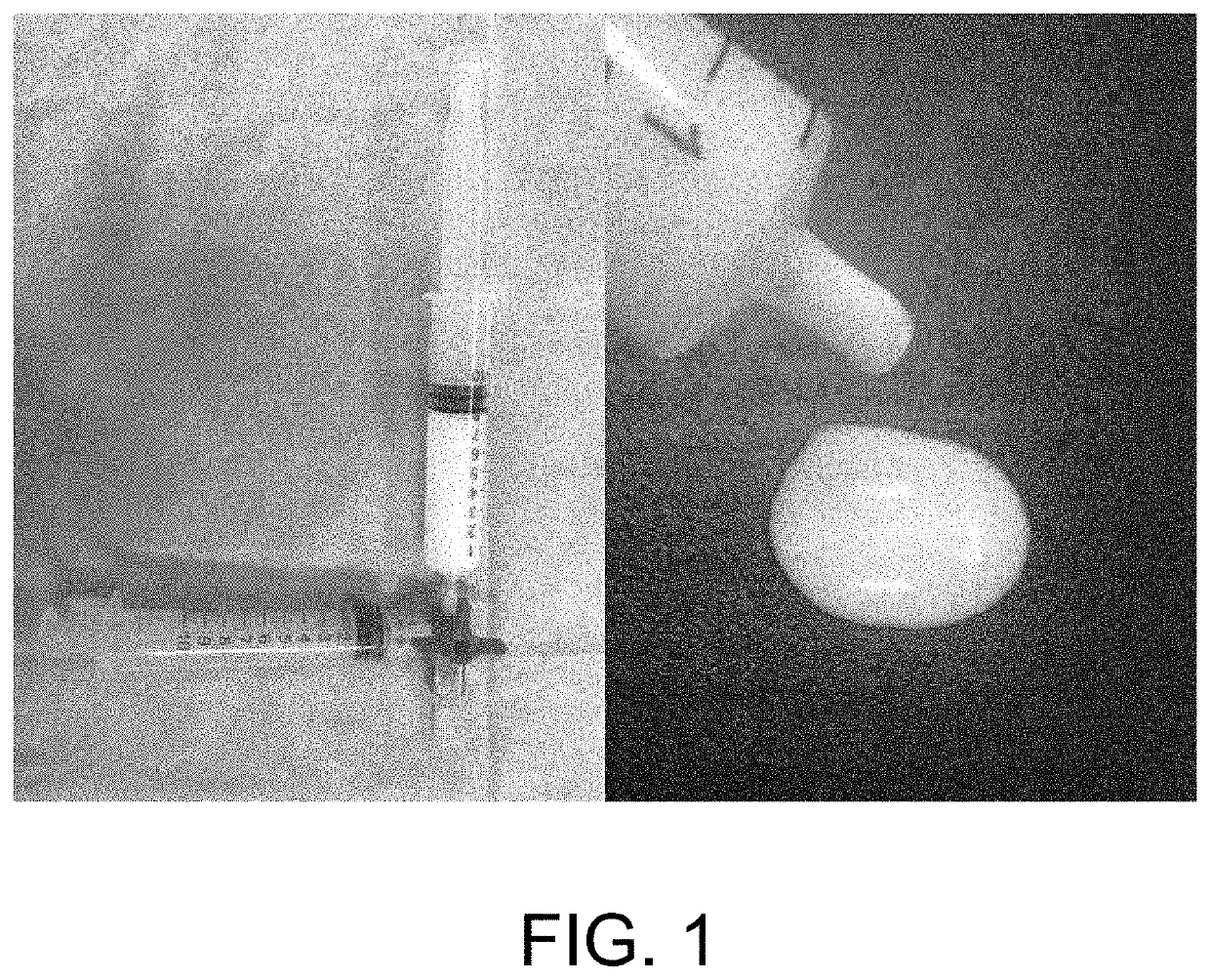 Ethanol foam sclerosing agent for treating vascular anomalies and preparation method thereof