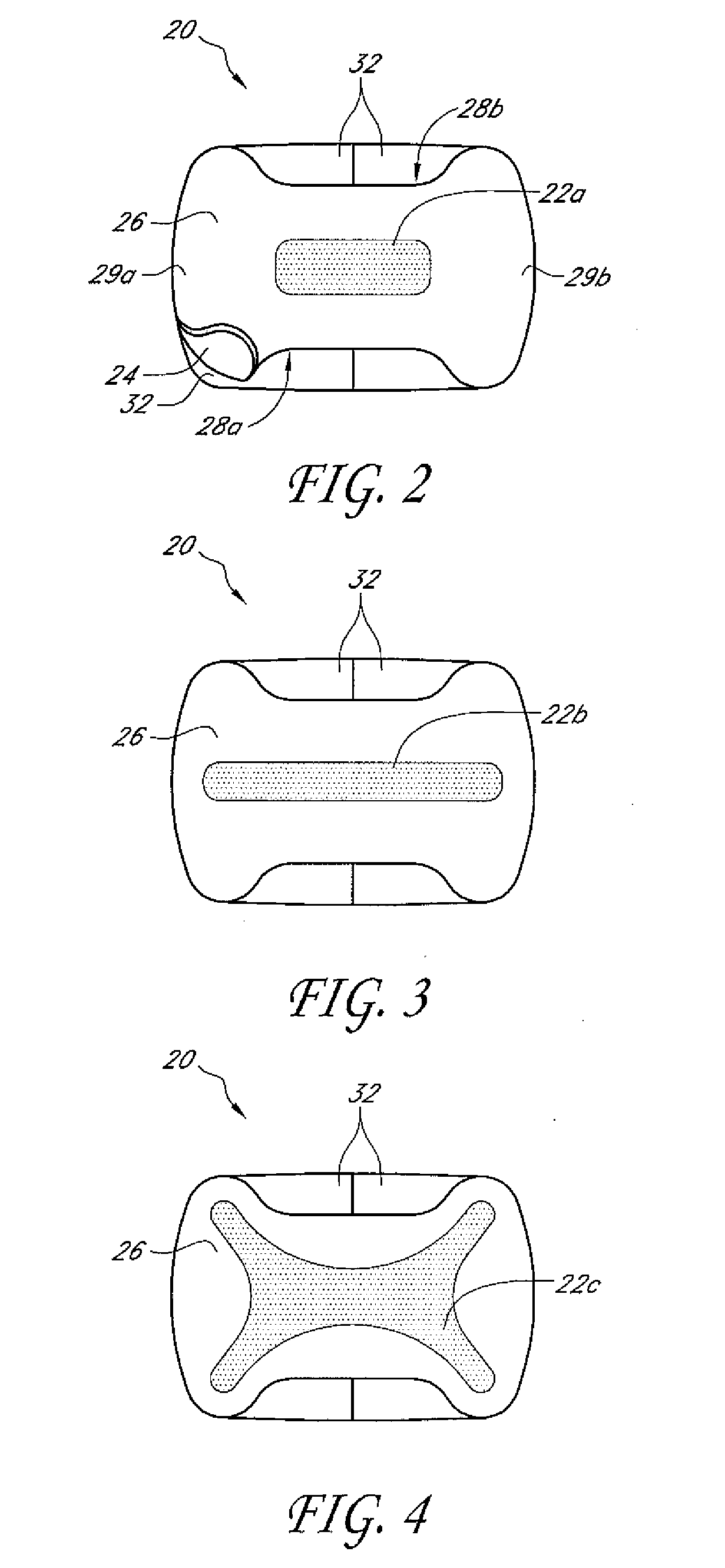 Securement system for a medical article