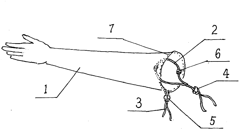 Adjusting fixation device for armlet, glove, leg protector, top of trousers, top of skirt, or cap opening