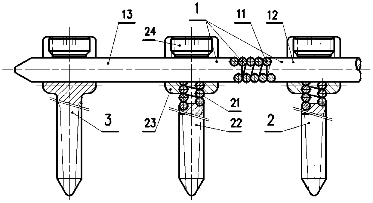 Bi-flexible vertebral arch pedicle screw rod fixation system for screw rod