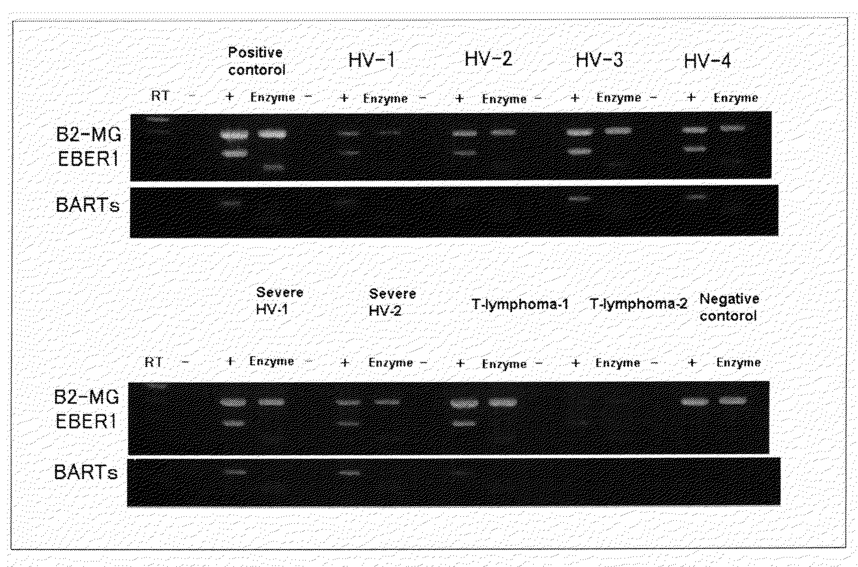 Detection Method For Latent Viral Infections and Its Kit For Examination