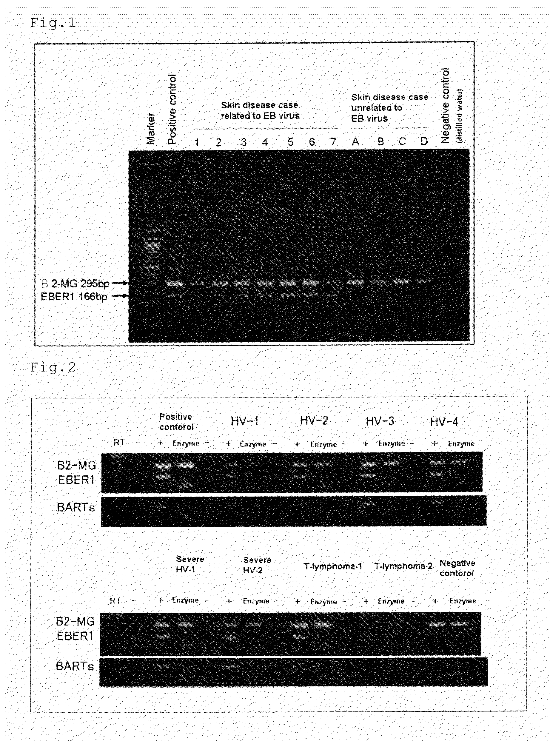 Detection Method For Latent Viral Infections and Its Kit For Examination