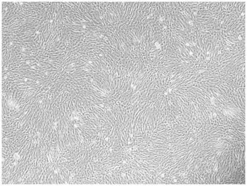 Method for separating and extracting amniotic membrane stem cells from placentas