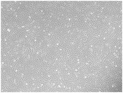 Method for separating and extracting amniotic membrane stem cells from placentas